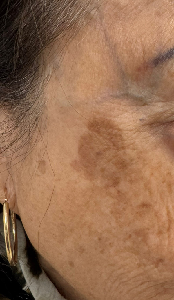 Client 1 - Before