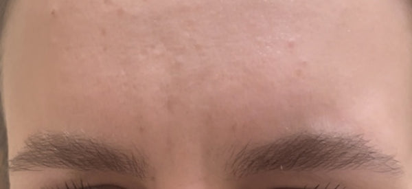 Client 3 - After