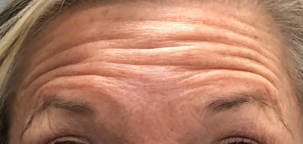 Client 1 - Before