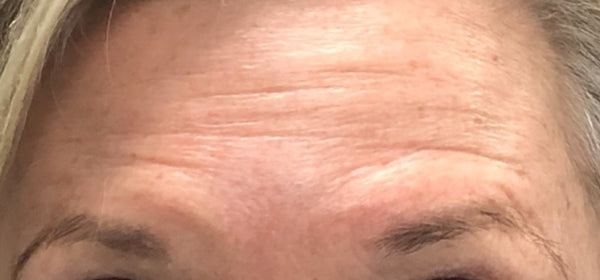 Client 1 - After
