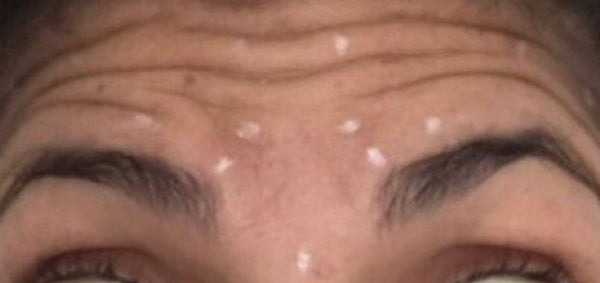 Client 6 - Before